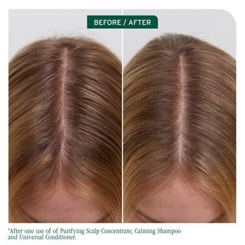 Scalp Sync Purifying Scalp Concentrate - Biolage Renovation NZ | L'Or&eacute;al Partner Shop